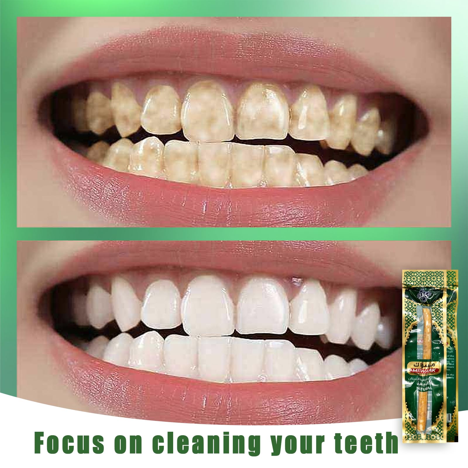 Eco-friendly traditional oral care: Miswak sticks