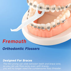 Close-up of thin control arm between teeth and brace wire