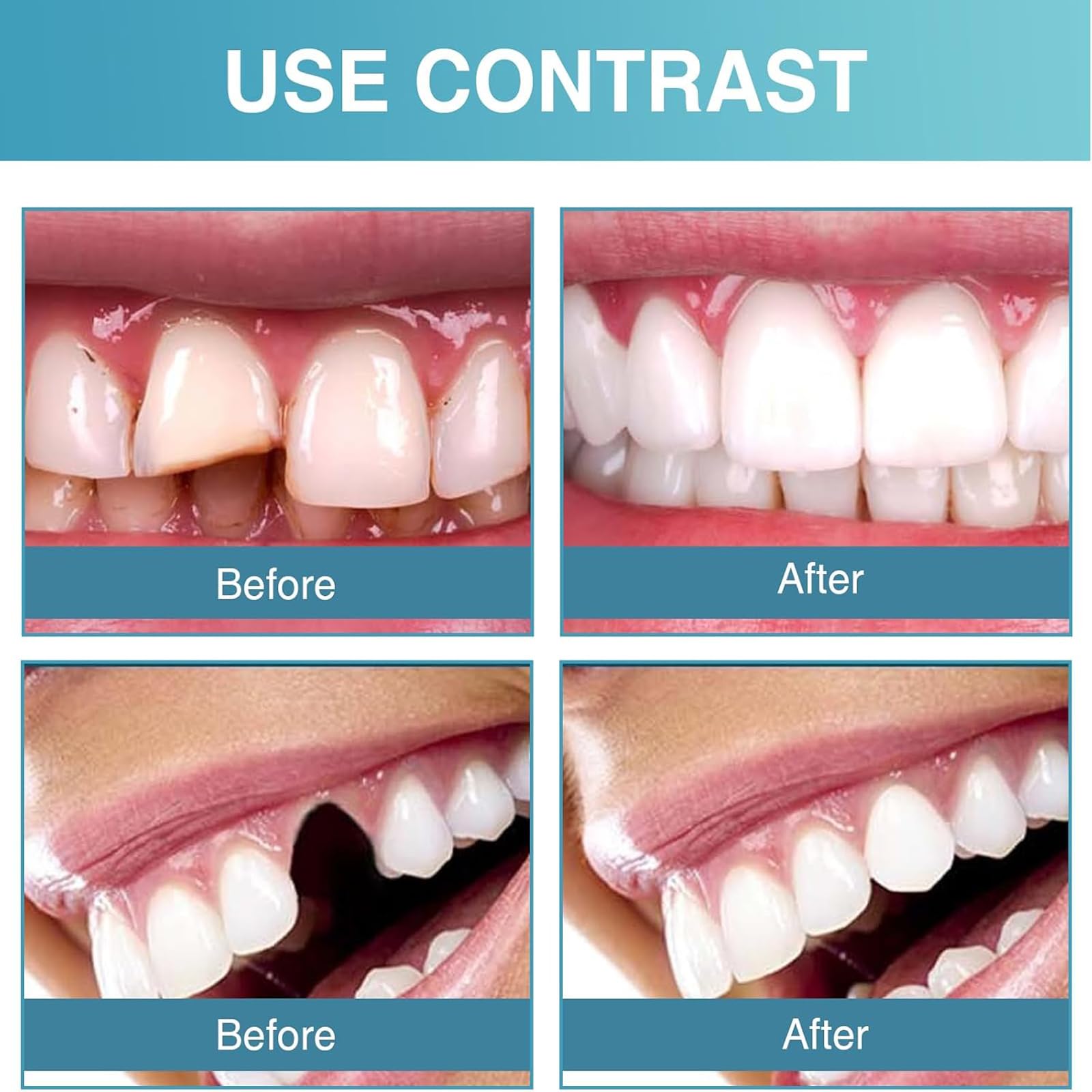 Dentures: easy to shape, apply adhesive, clean and soak