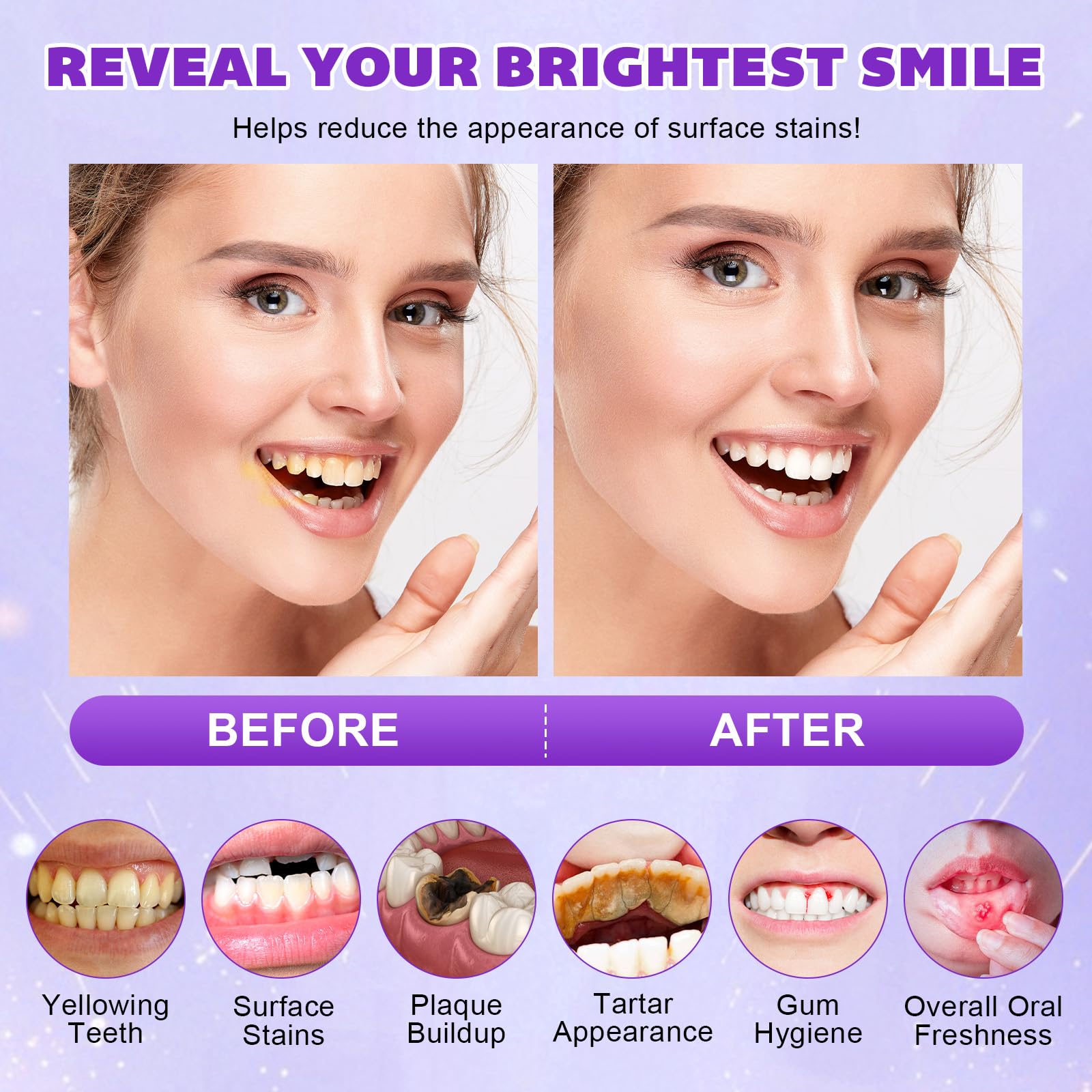 Gentle enamel care close-up