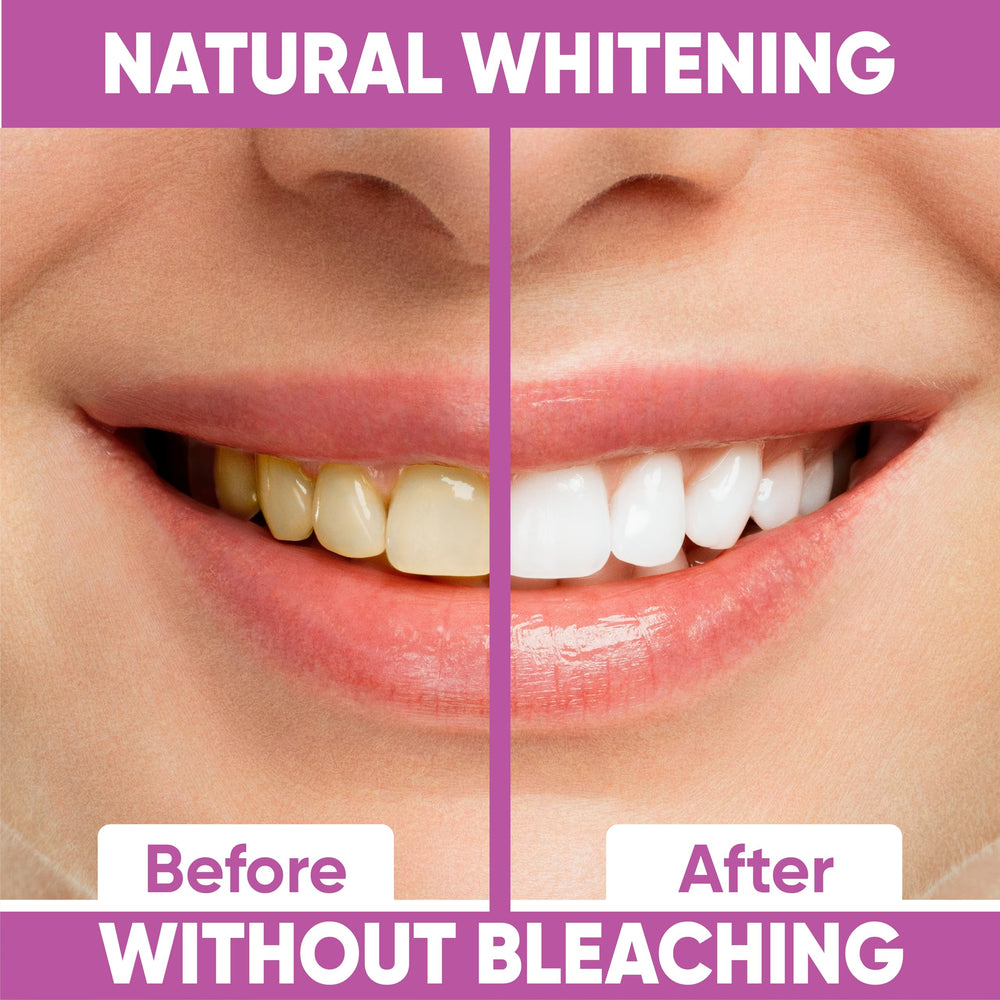 Whitening strip being peeled from the foil