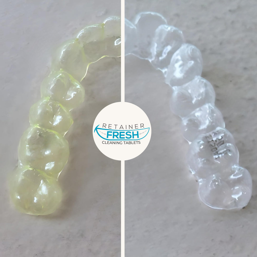 Getting started with Aligners eBook