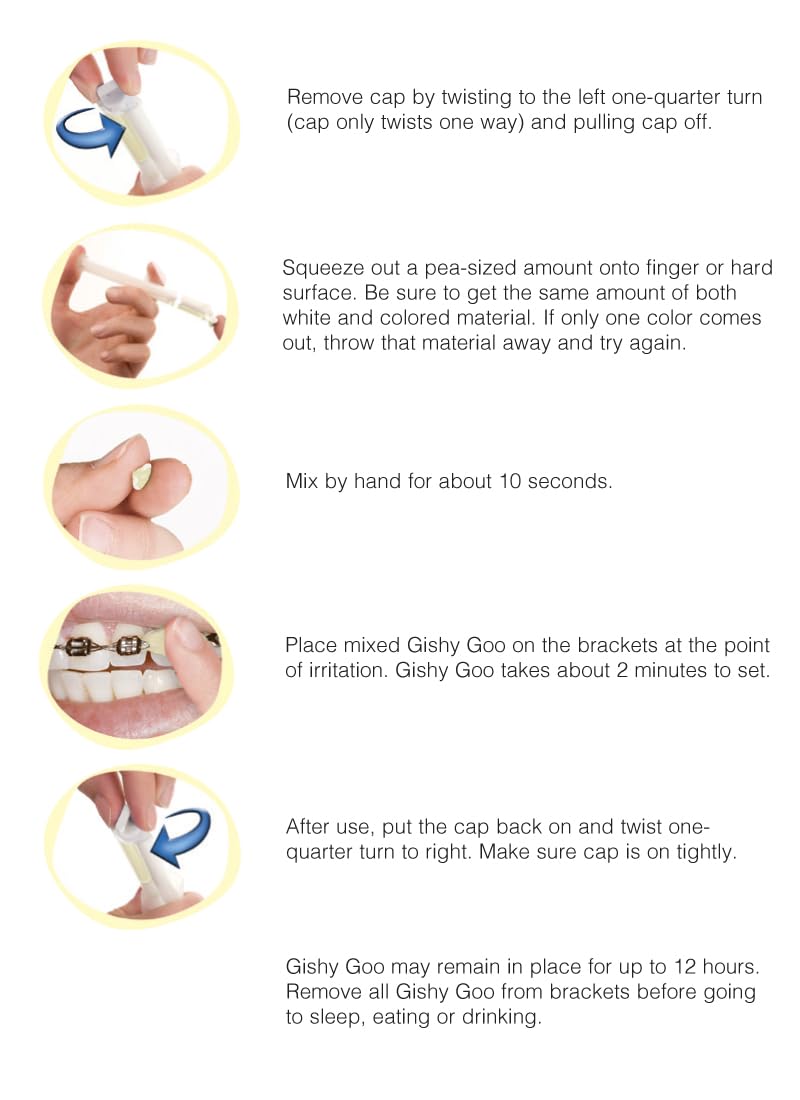 Close-up of GishyGoo syringe and bracket-relief wax application on braces (10 count)