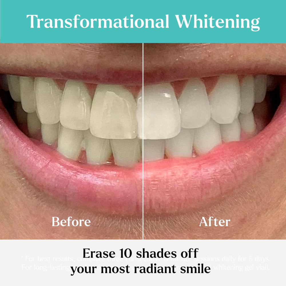 Dentist-designed GLO Science whitening technology