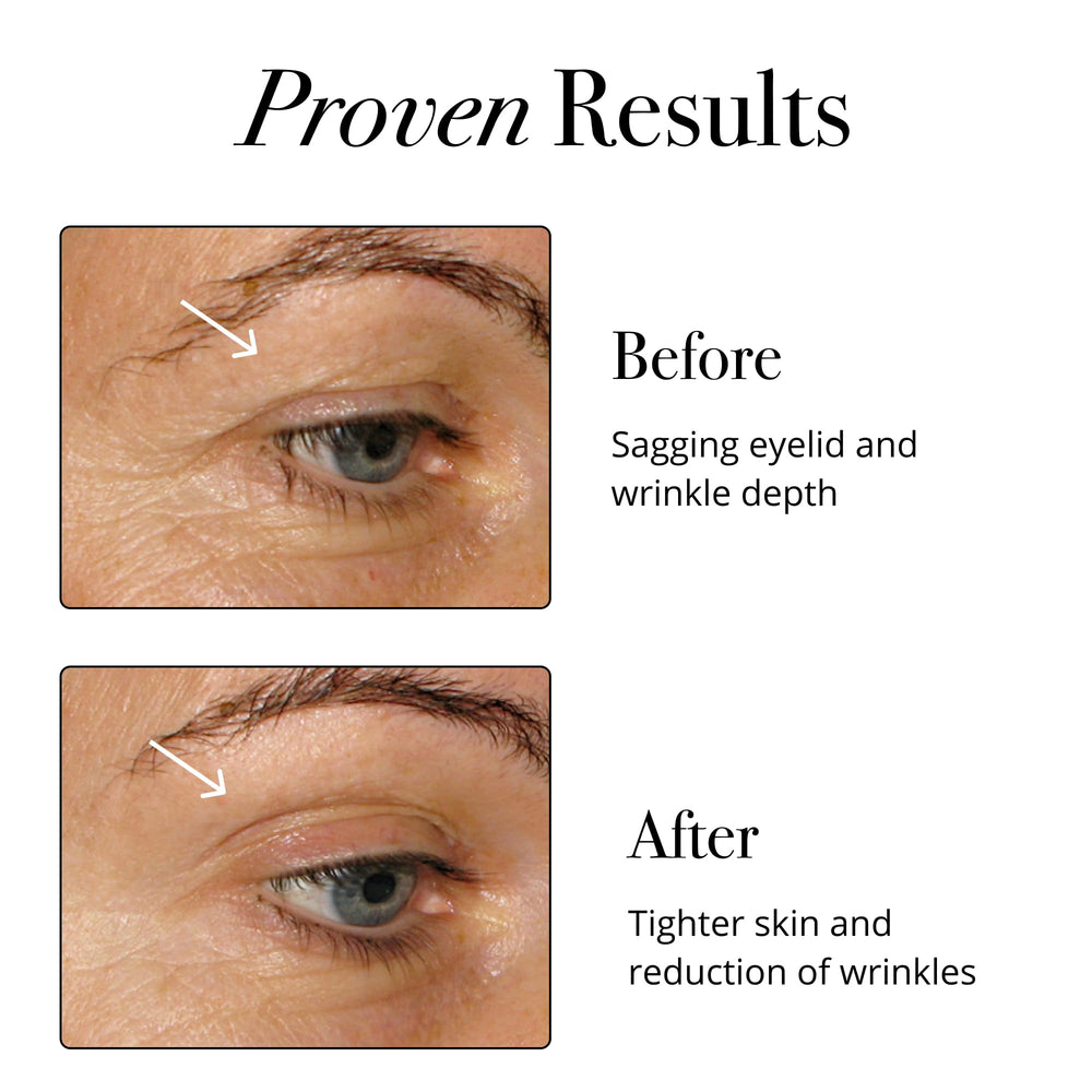 Dissolving powder in a glass of water for Glotrition Elixir