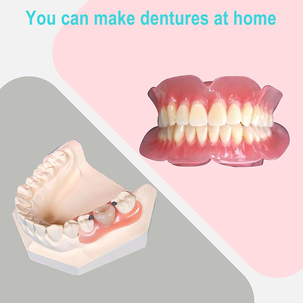 Gypsum model top mold for denture