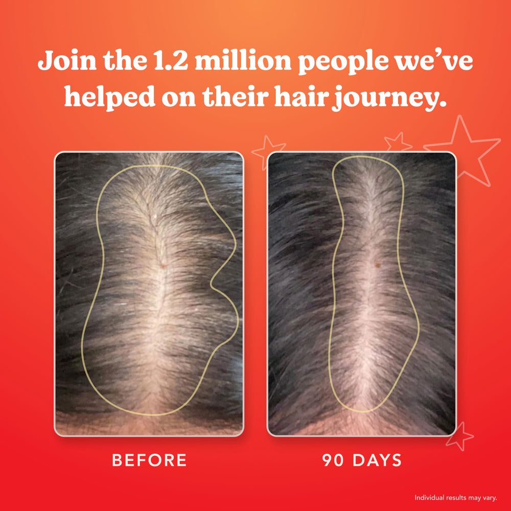 30-day supply of HAIRtamin MOM capsules