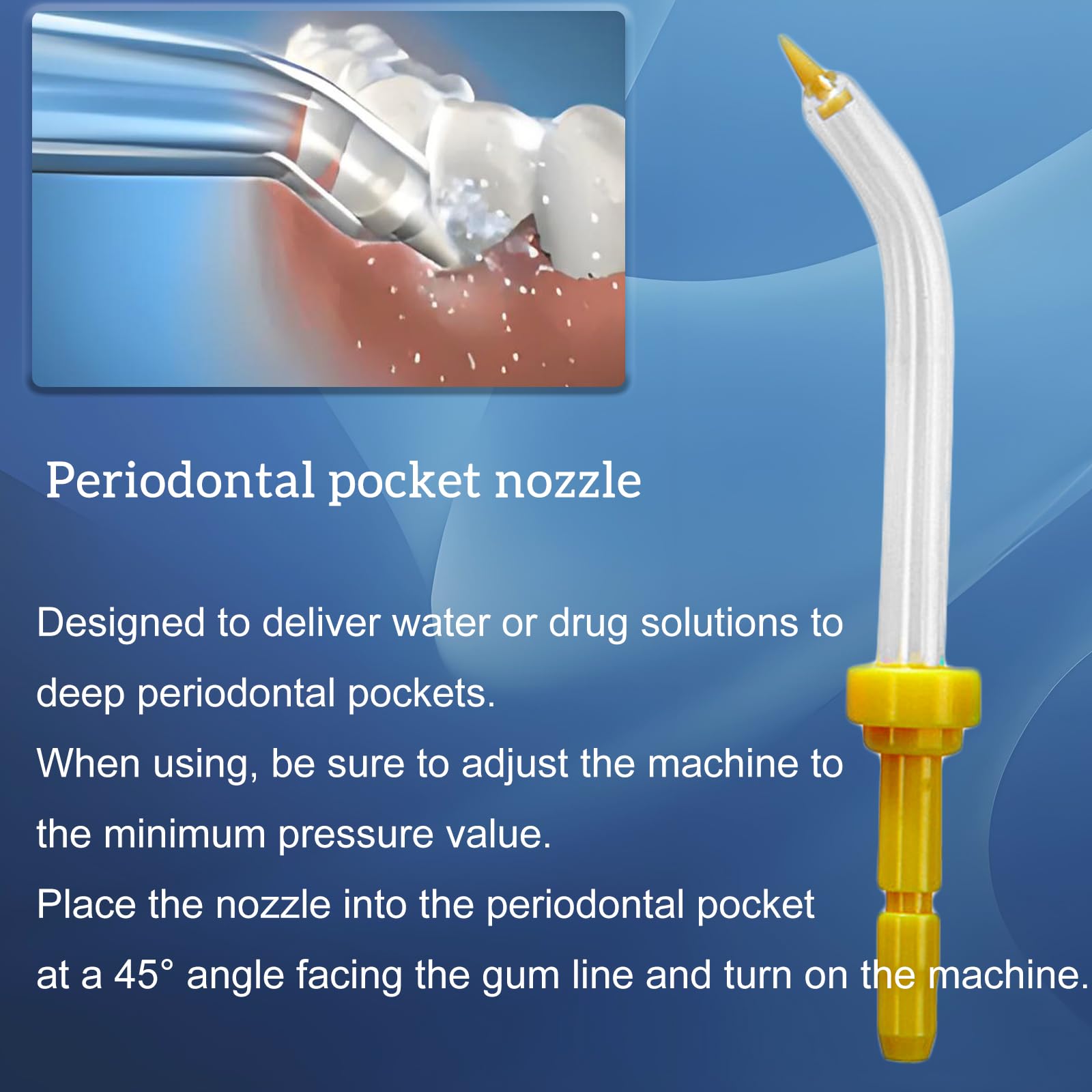 Orthodontic tip compatible with braces