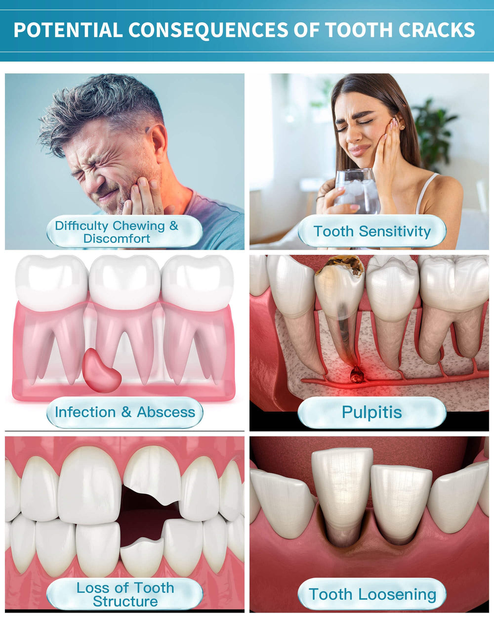 Dentine repair process showing cracks sealing