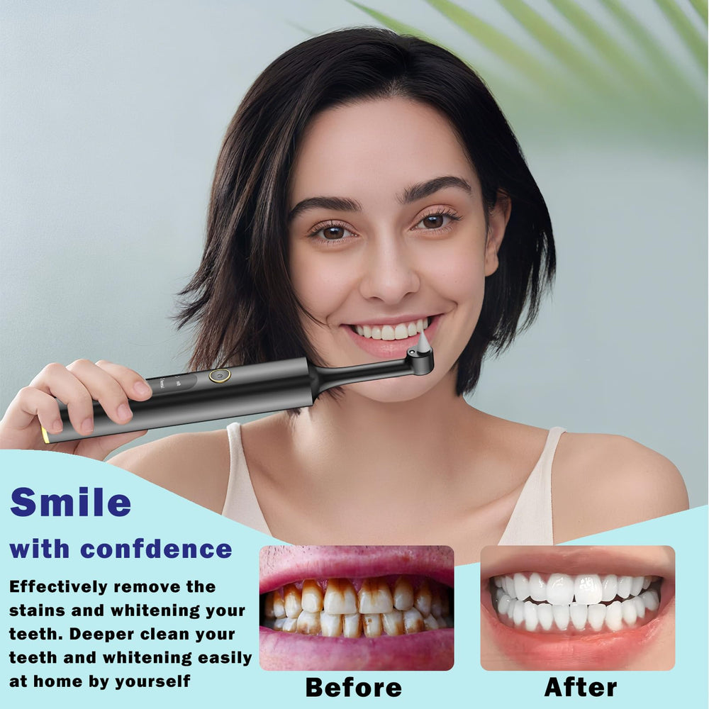 Home use dental cleaning and polishing kit
