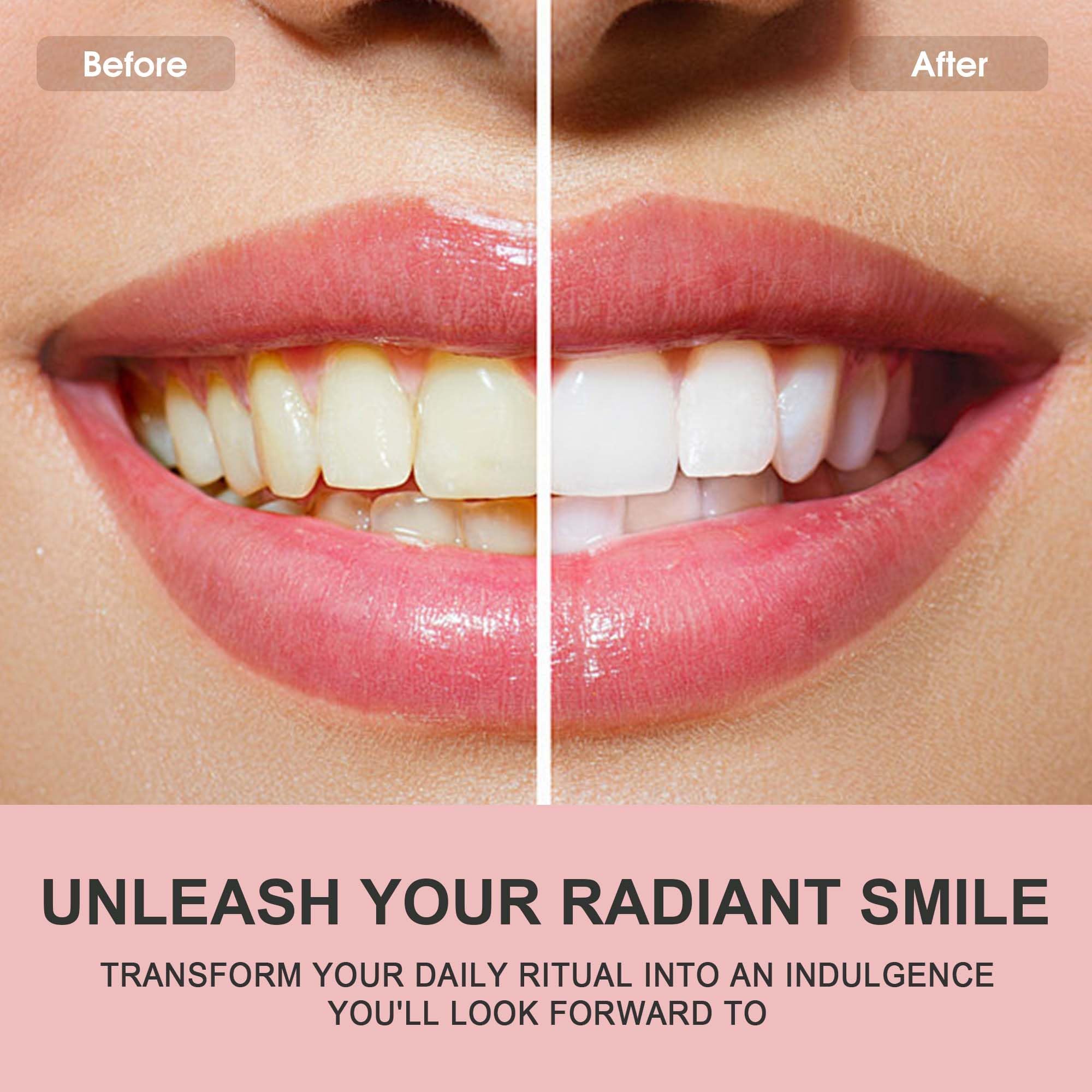Stain removal action with hydrated silica in Hotluck toothpaste