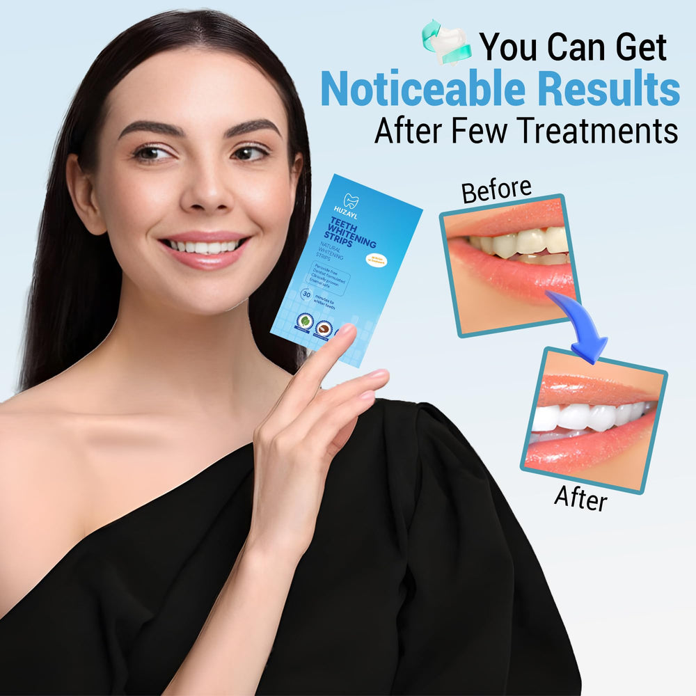 Before and after whitening results with Huzayl Strips