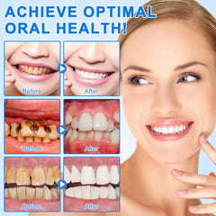Nano hydroxyapatite toothpaste illustration