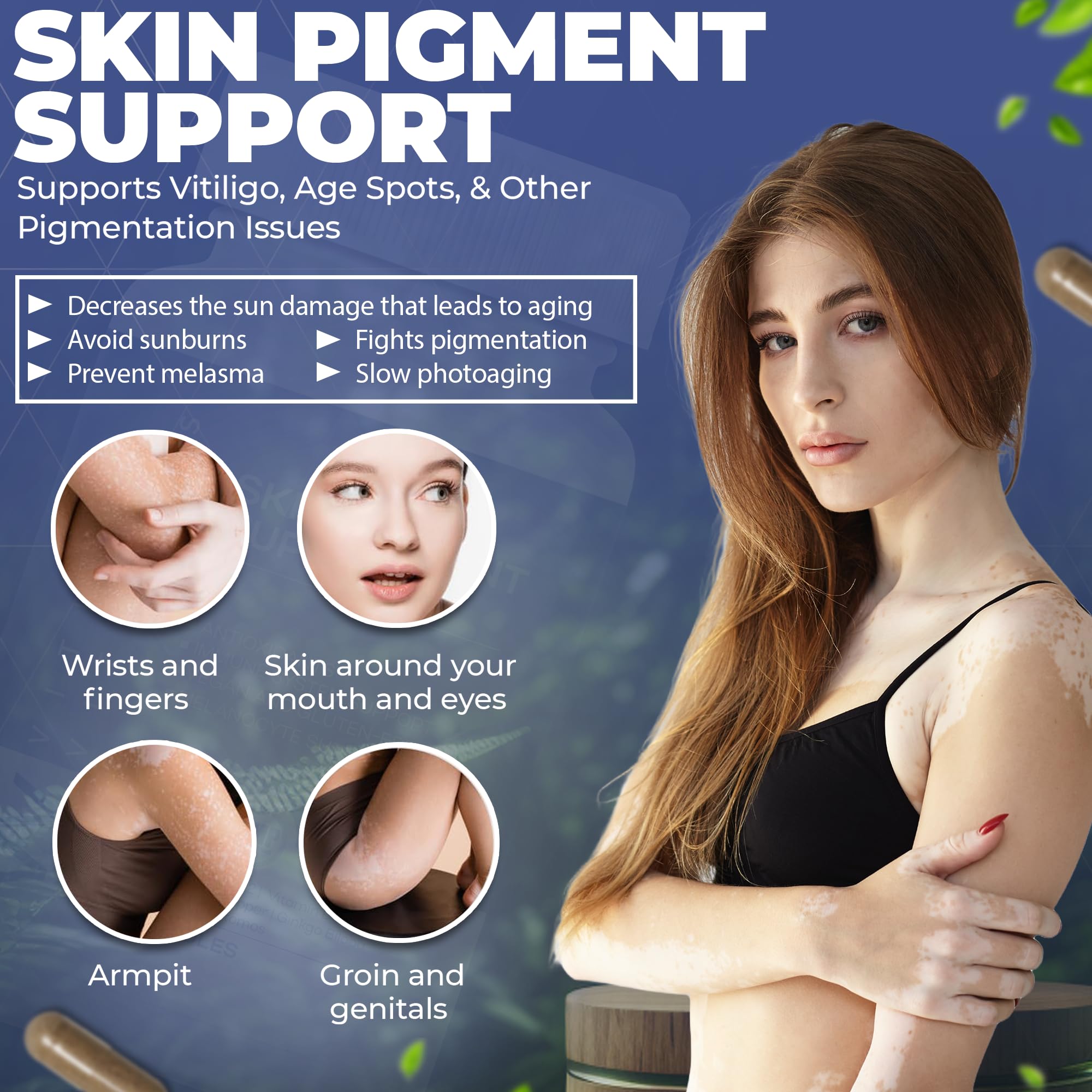 Hypopigmentation skin tone support imagery