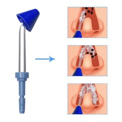Nostril irrigation replacement tips compatible with Waterpik