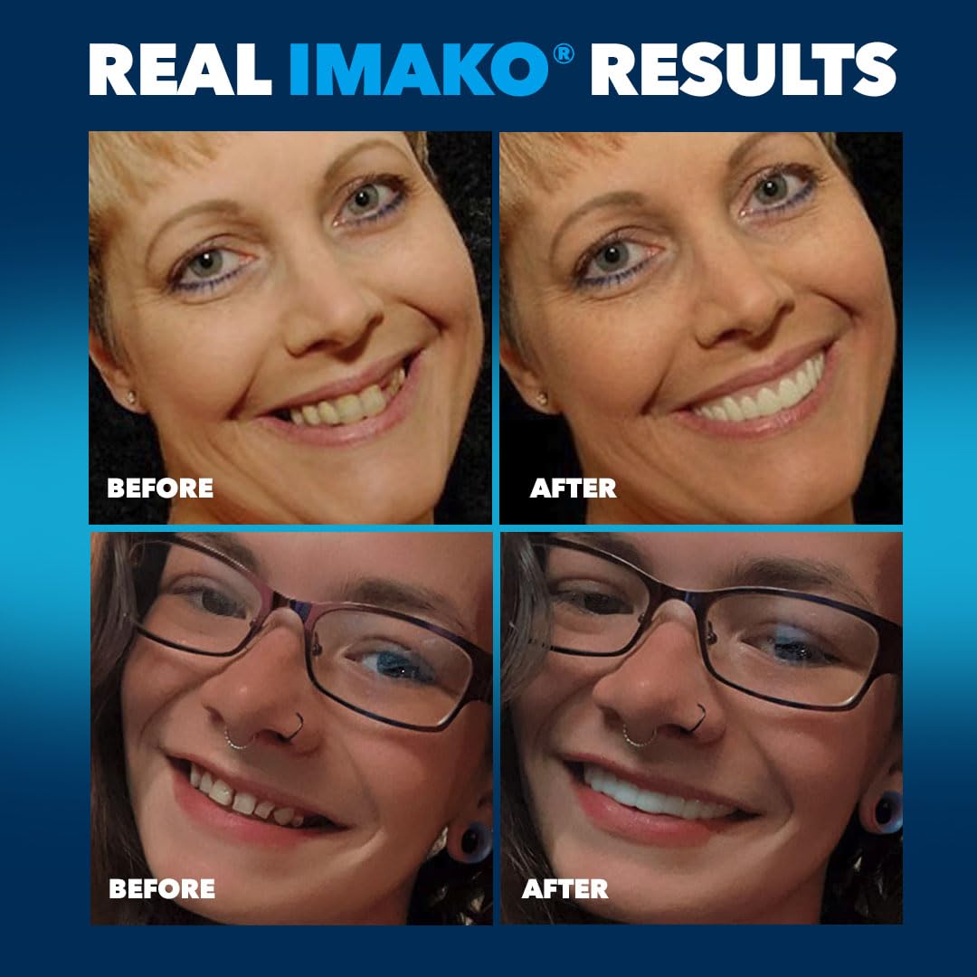 Flat lay of Imako 2-pack small cosmetic uppers
