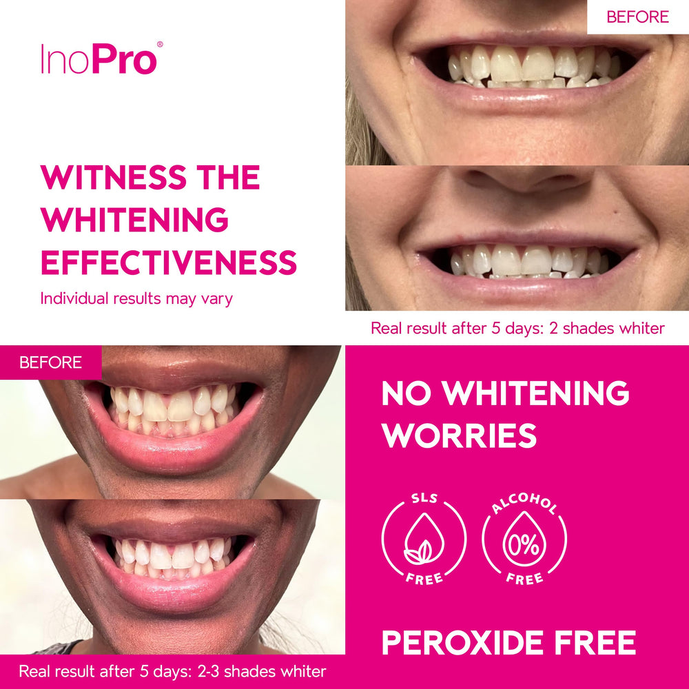 Close up of whitening strip applied to tooth