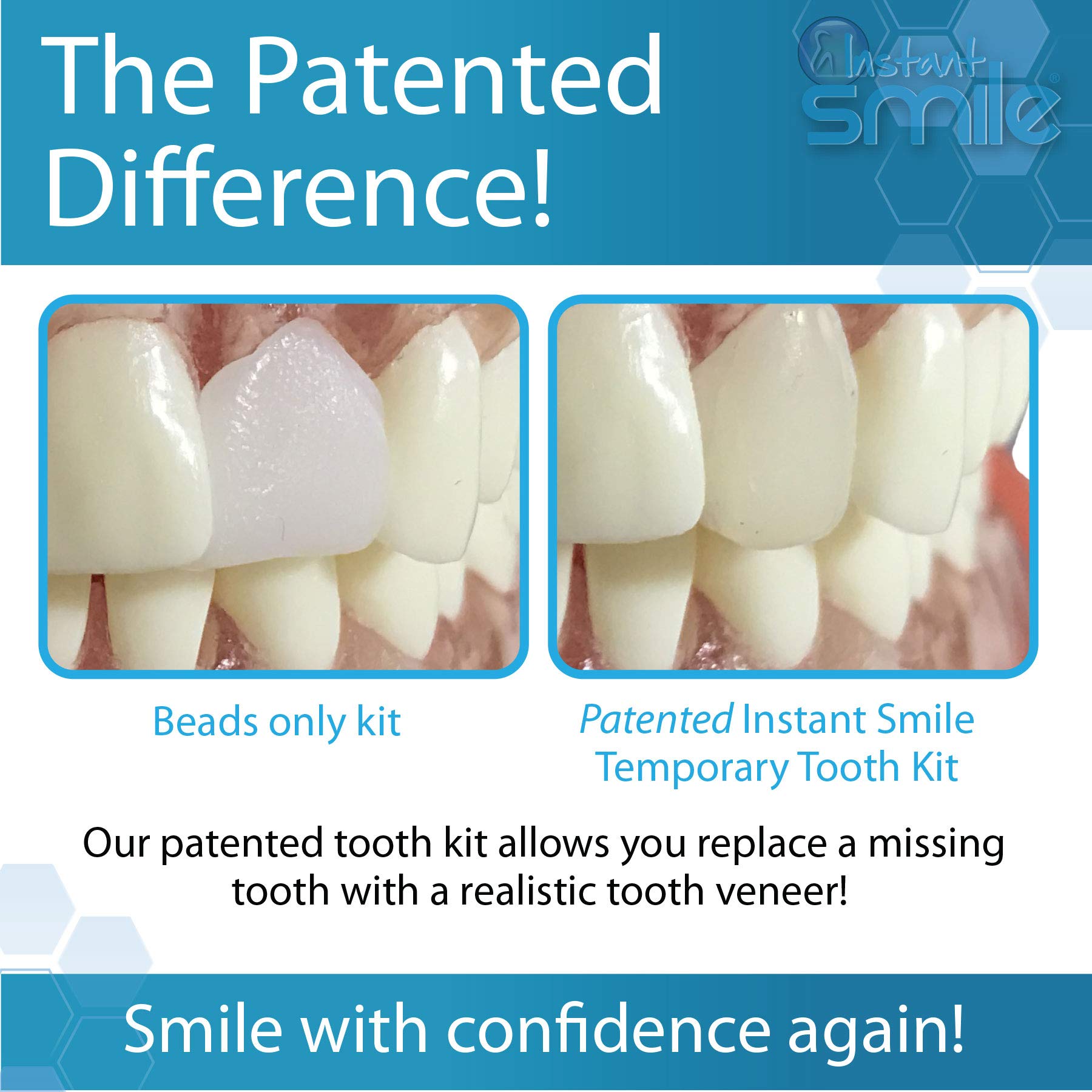 Overview of the Instant Smile kit being applied