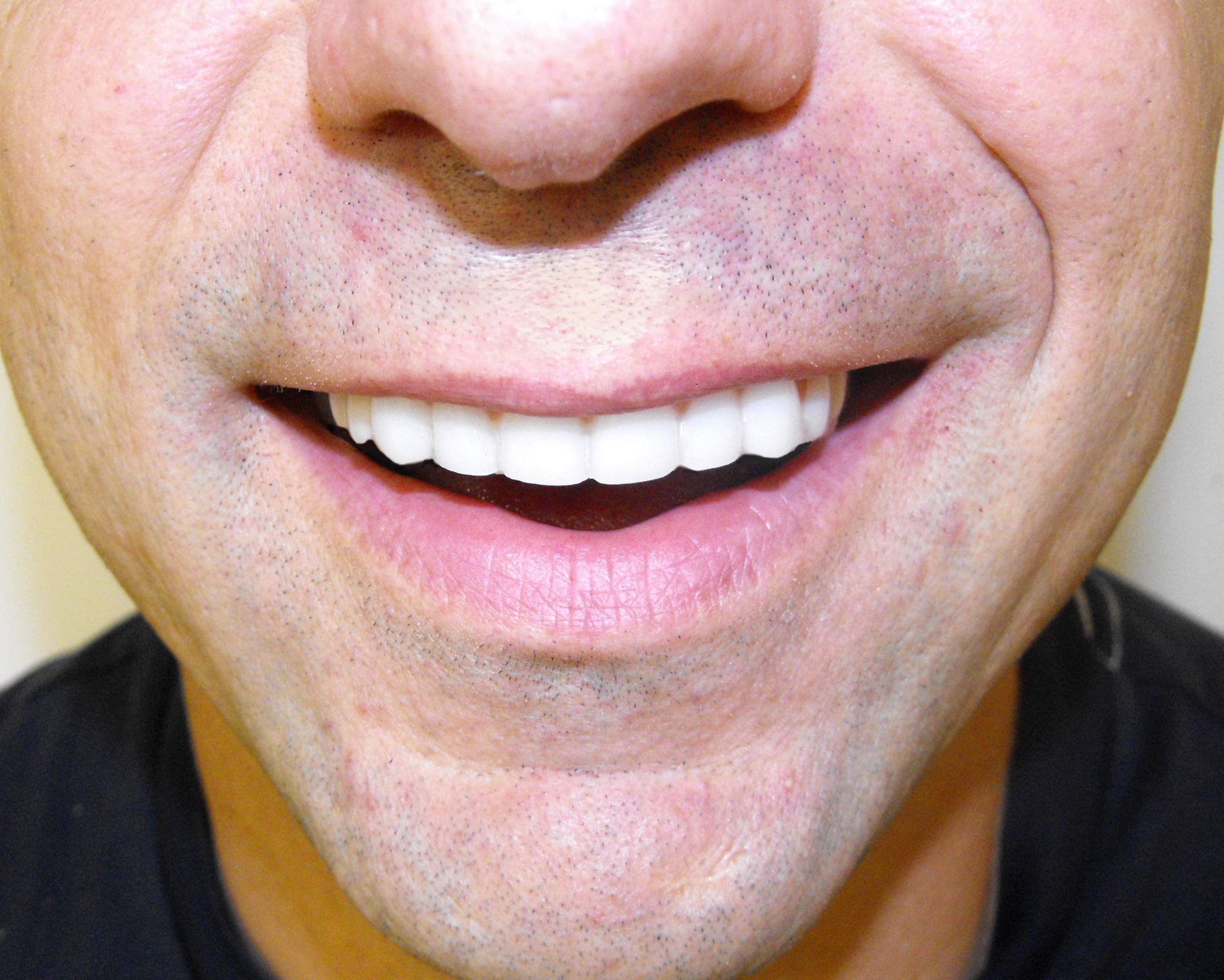 Product shot showing natural color lower teeth on neutral background