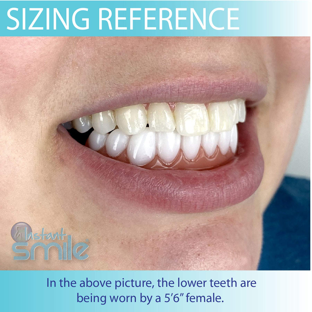 Fitting material included with Instant Smile lower veneer kit