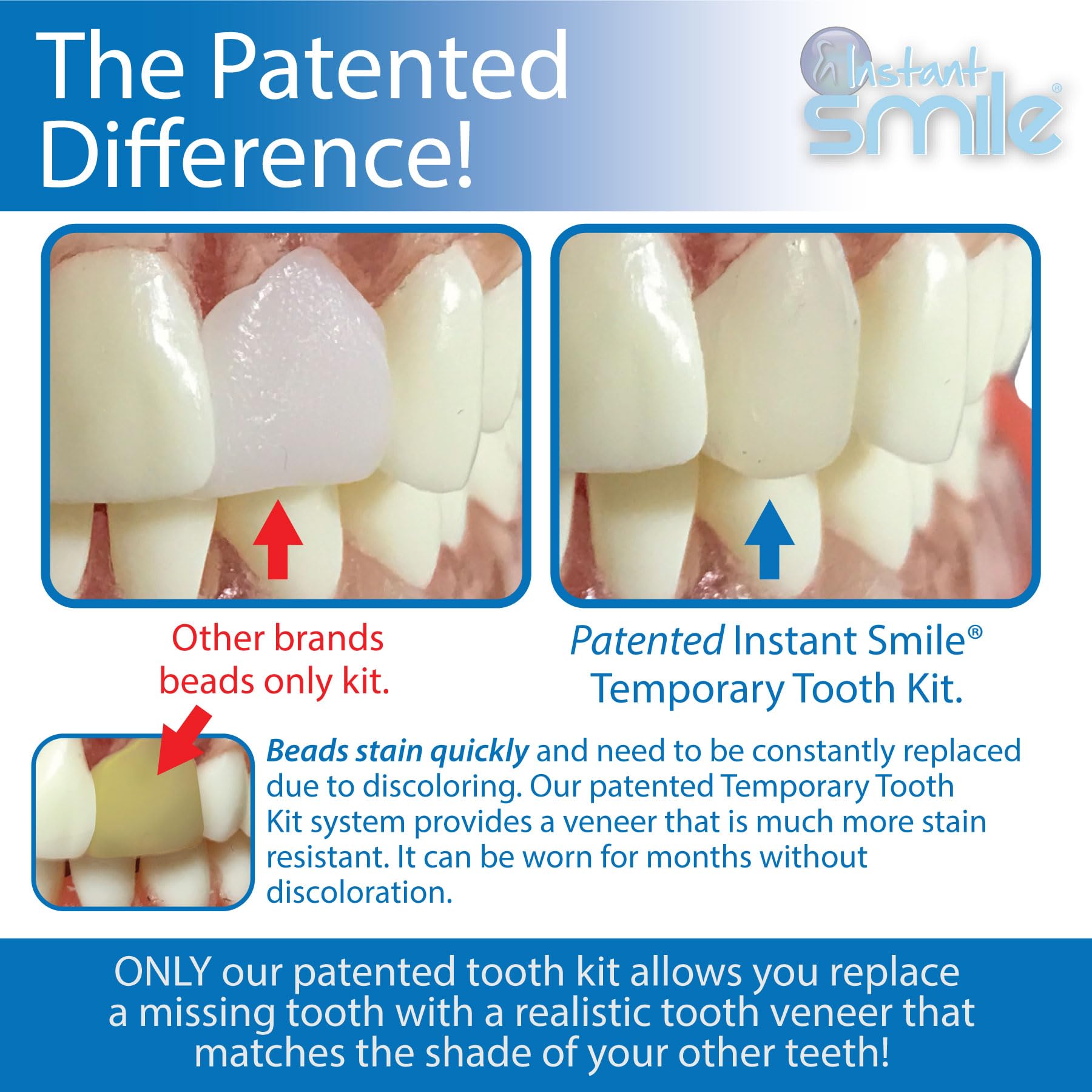 Patented, realistic temporary tooth design from Instant Smile Pro Series