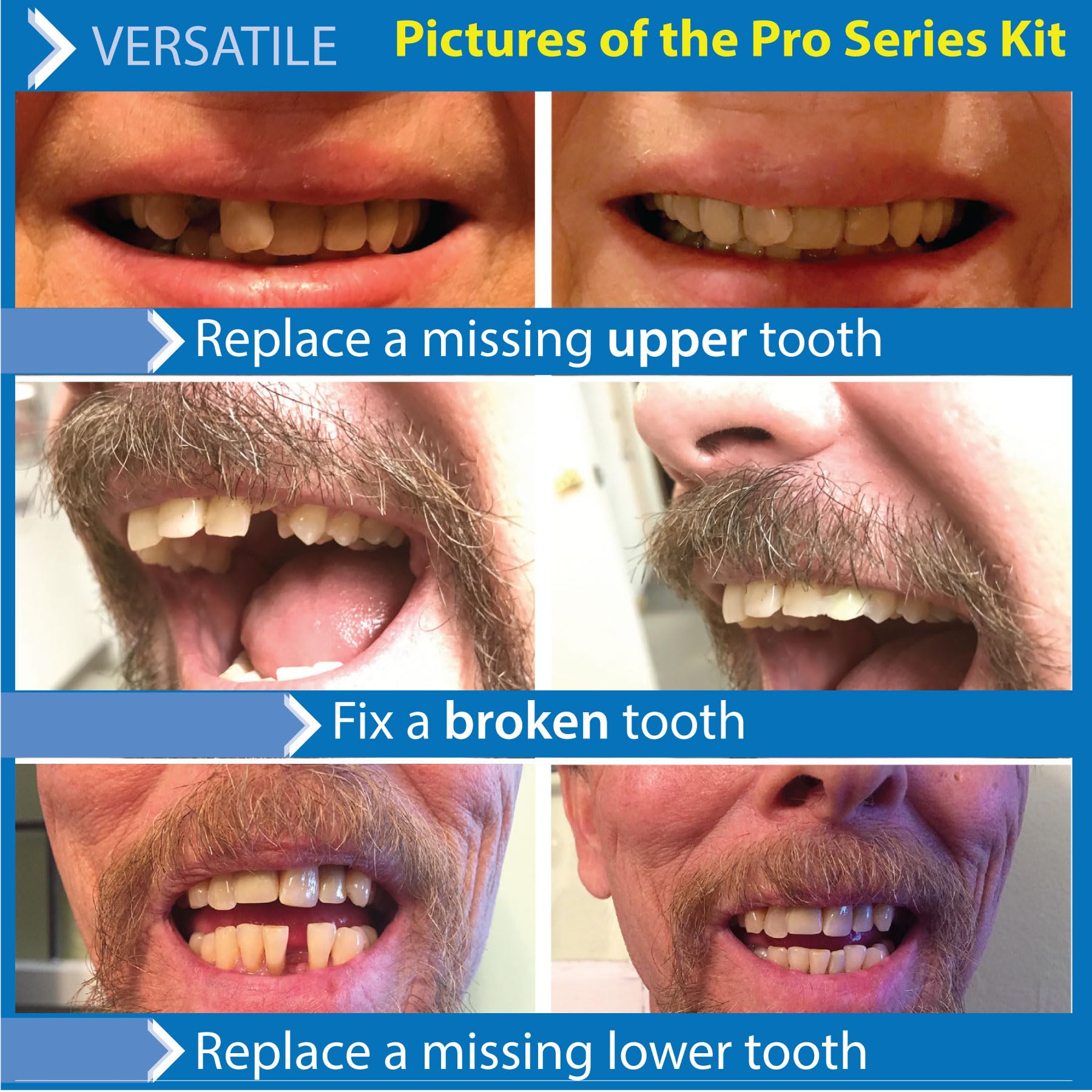 Kit packaging showing contents and extra beads included