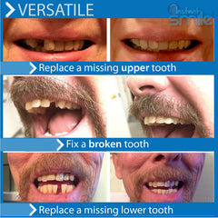 Realistic temporary tooth molded in the shape of an actual tooth