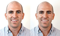 Three shade options and 9 molded teeth displayed for fast replacement