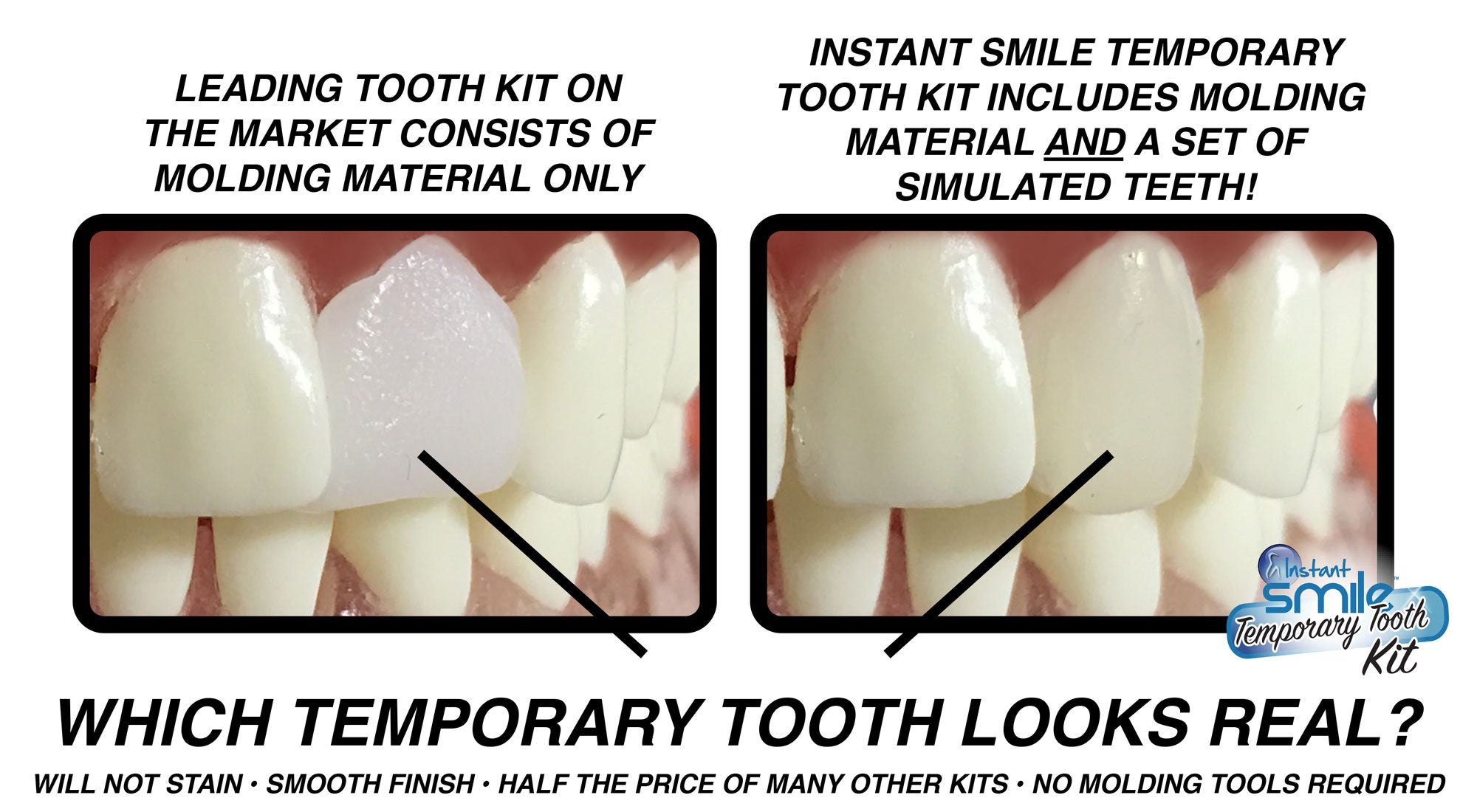 Temporary single-tooth replacement for upper or lower jaw