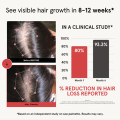 Close-up of iRestore hair growth capsules