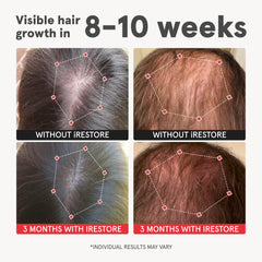 Close-up of iRestore Lustriva black bottle