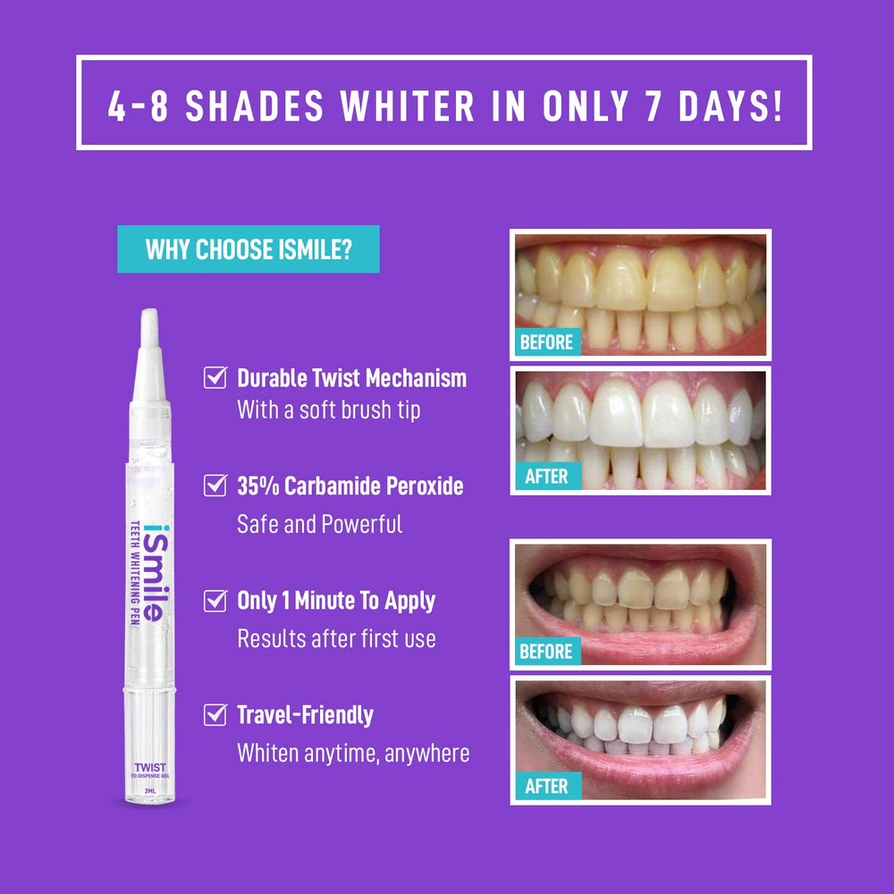 Close-up of iSmile whitening gel on the brush