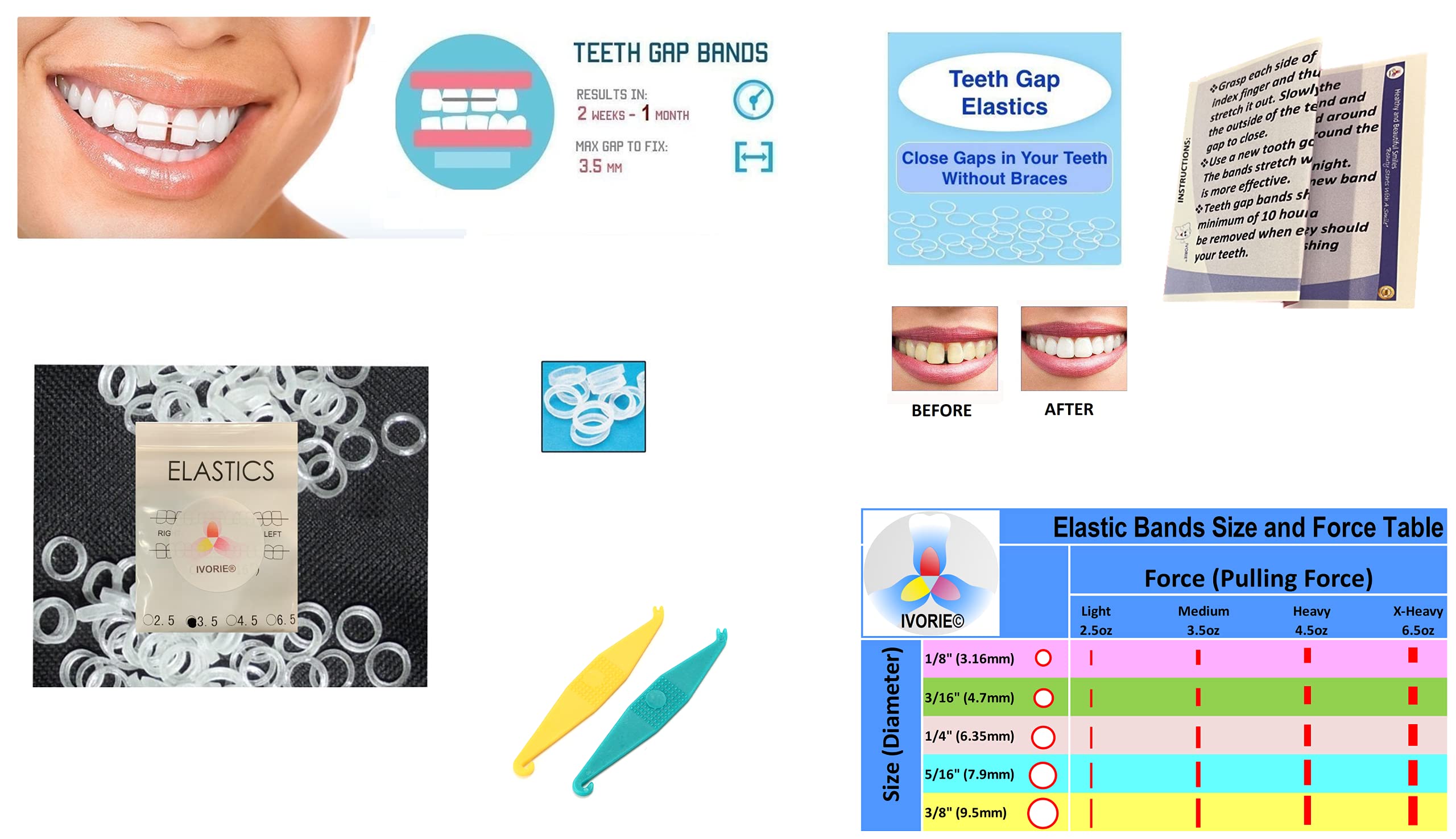 Dental braces elastics set for teeth gap closure, IVORIE, 3/16 inch Rabbit, 60pcs