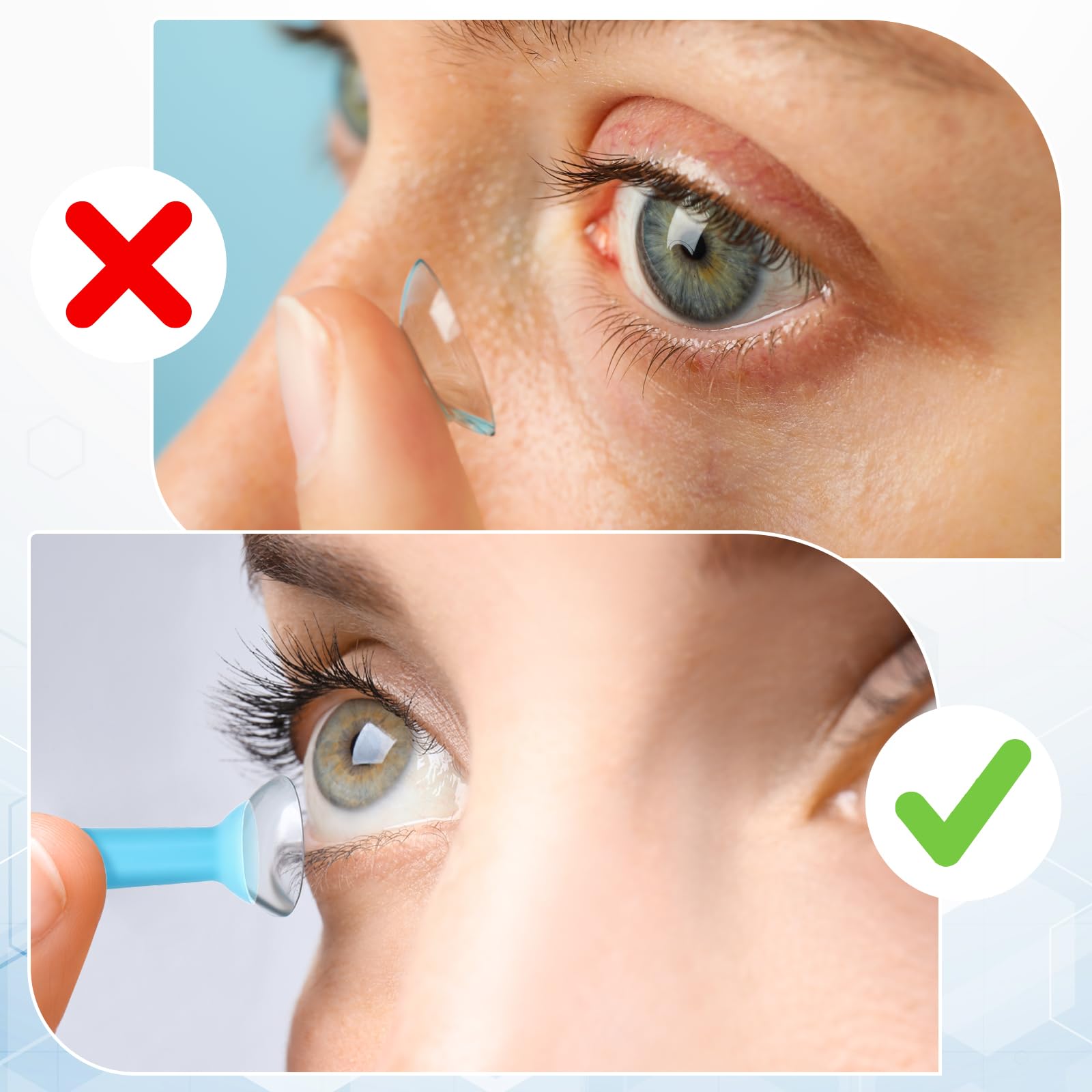 Travel-ready blue JIEYAO lens remover in compact case – image 6