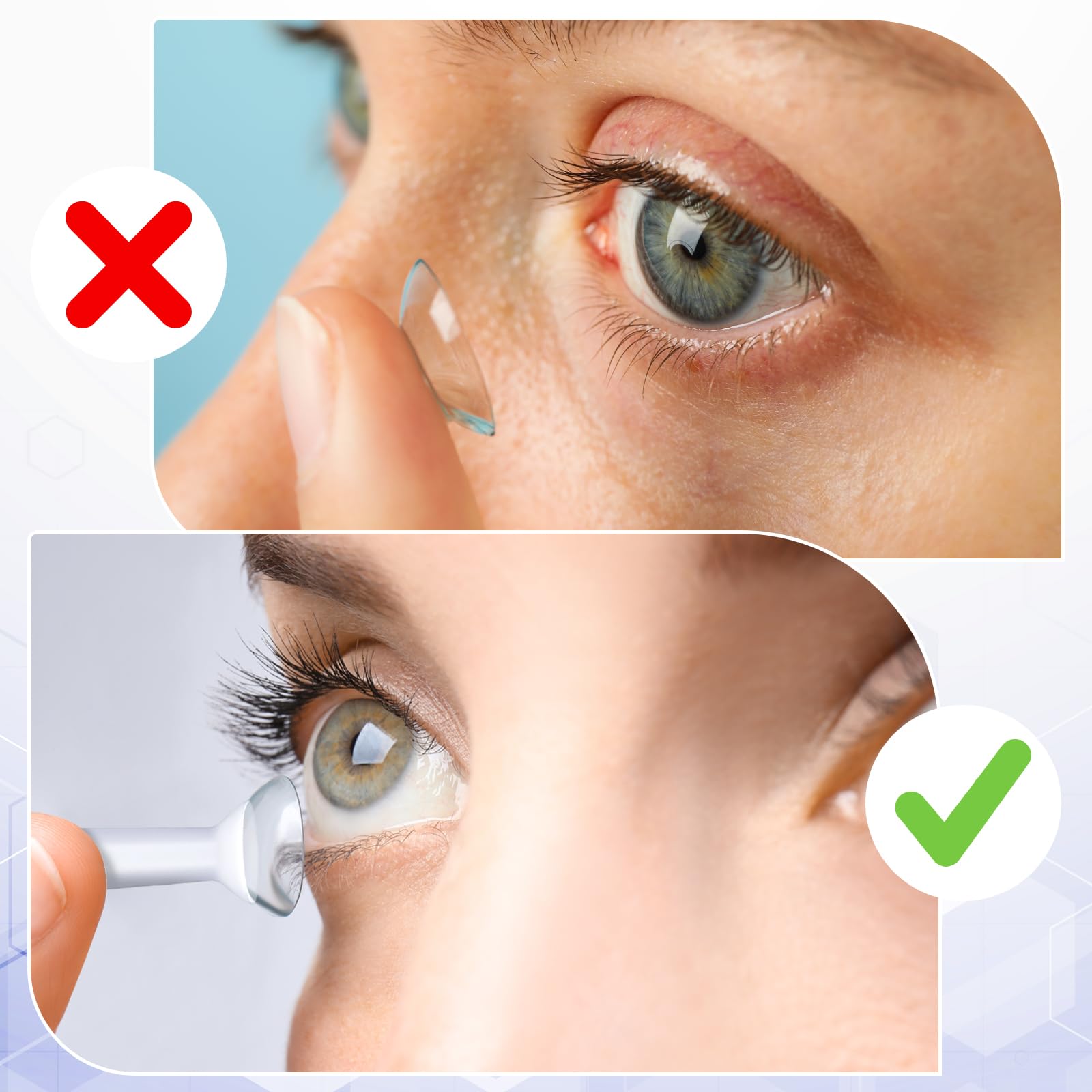 Close-up of silicone eye suction cup for scleral lens removal