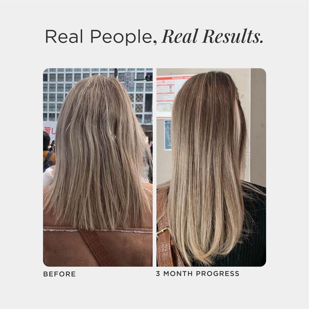 Iodine-rich kelp used in JSHealth Hair Formula