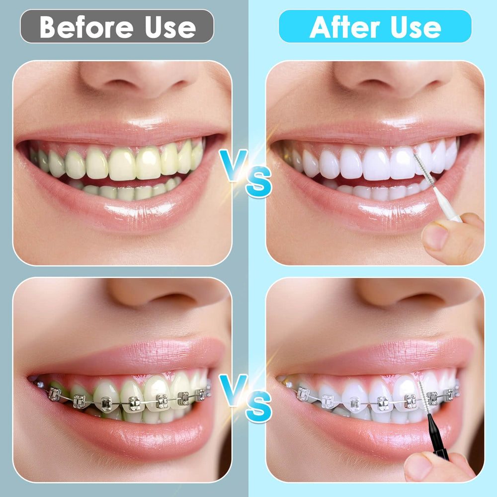 Using Jupwalz interdental brushes for teeth cleaning