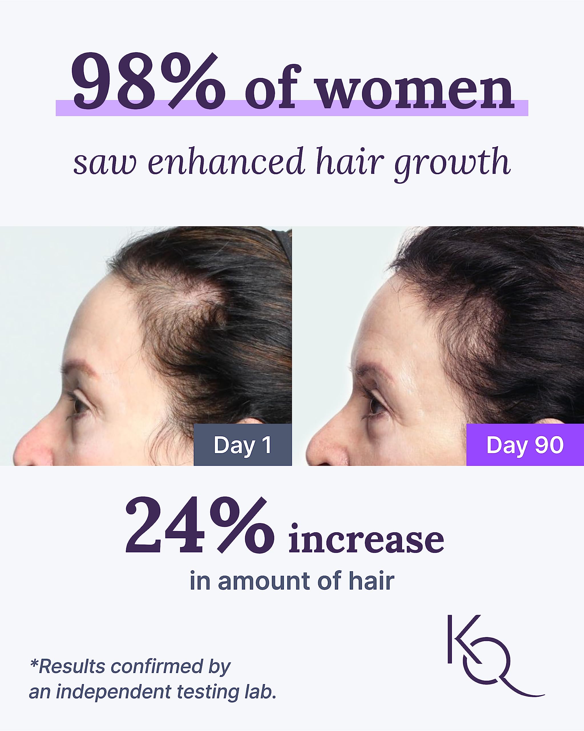 Close-up of Keranique hair & scalp supplement capsules