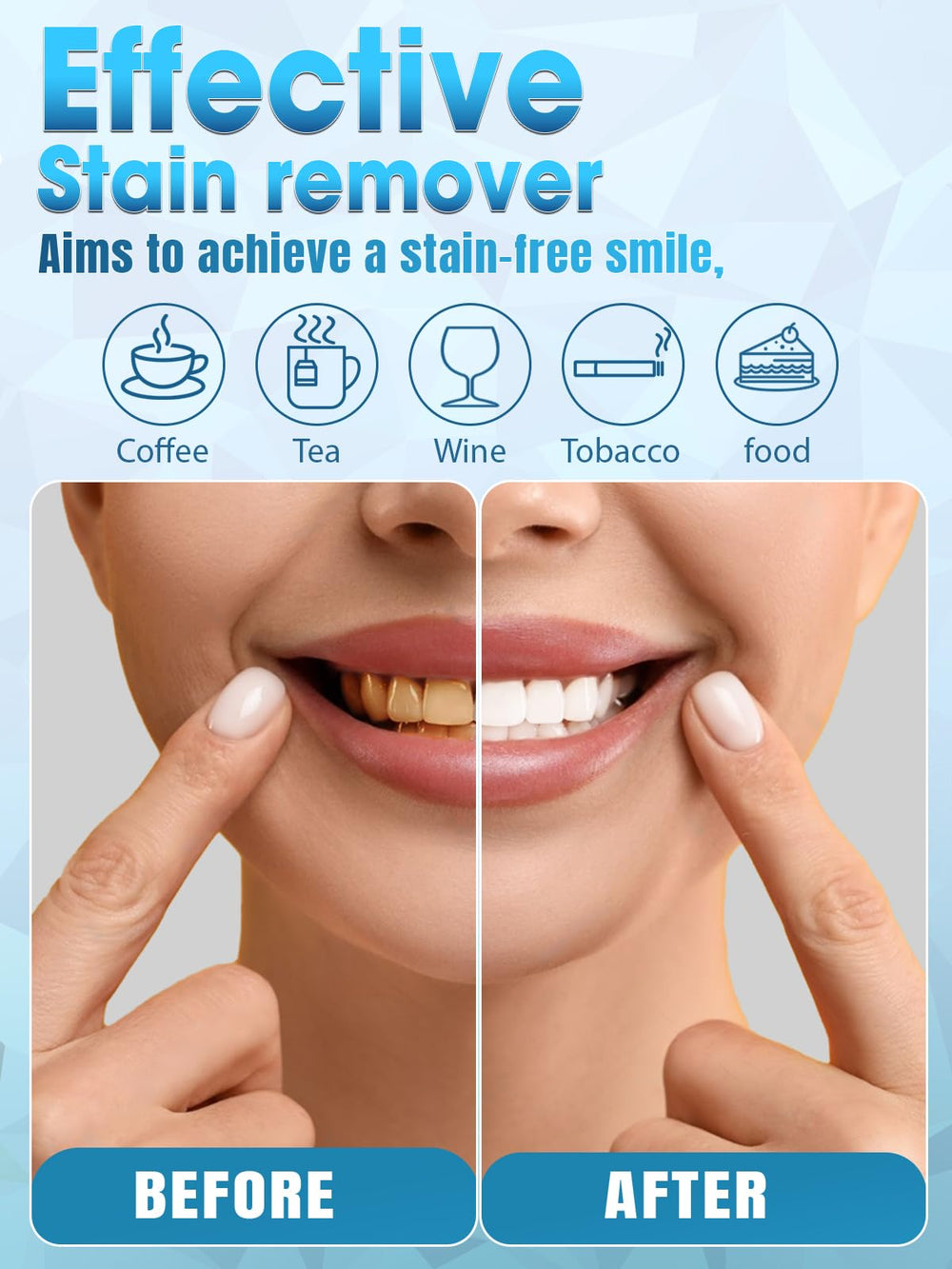 Whitening kit being used at home