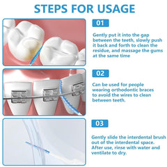 Interdental brush reaching between teeth and braces