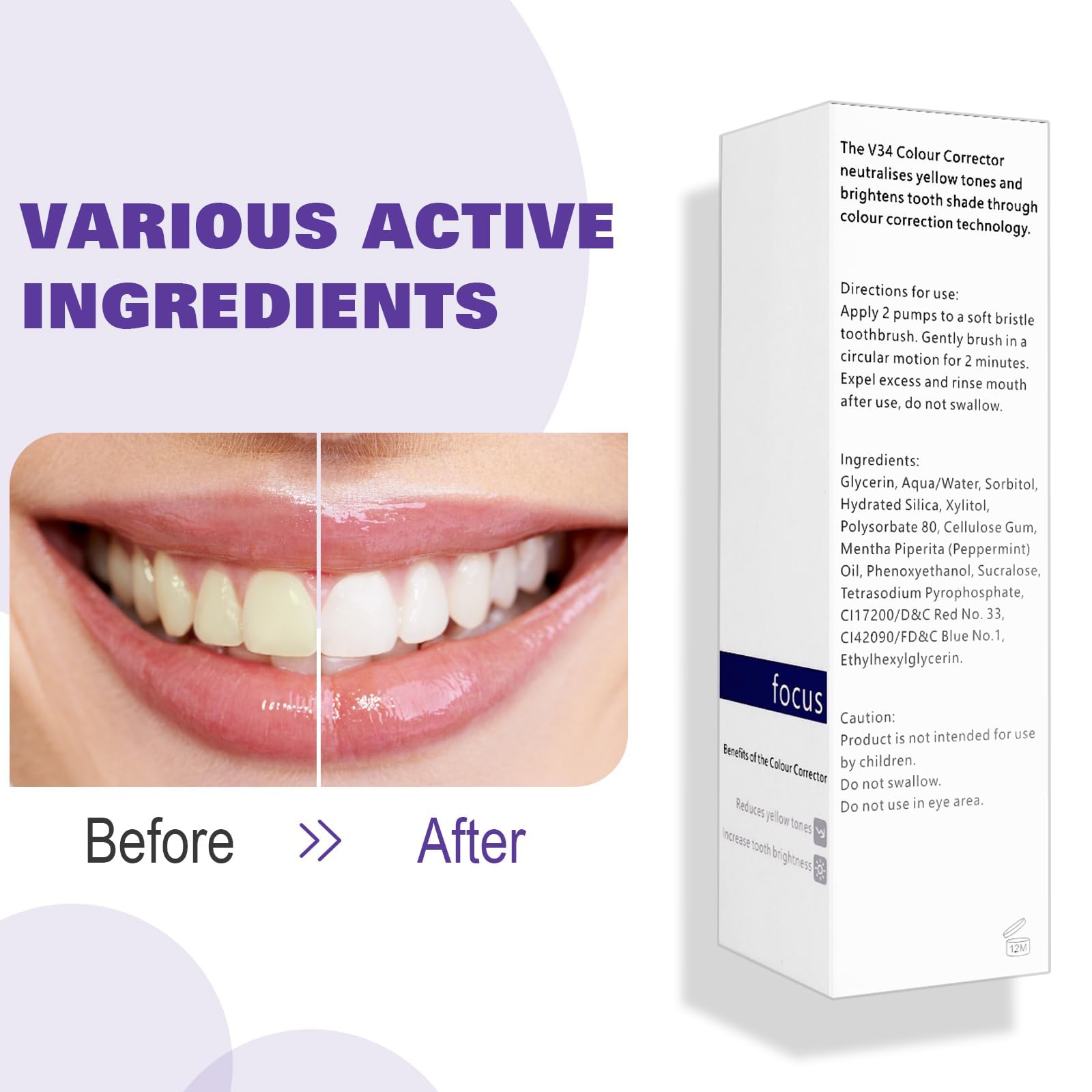 Note: not a full whitening treatment