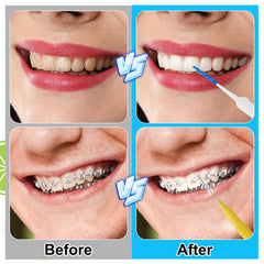 Bendable silicone dental brushes reaching all angles between teeth
