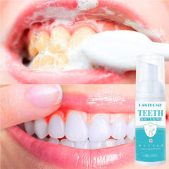 Foam reaching corners to clean teeth and gums