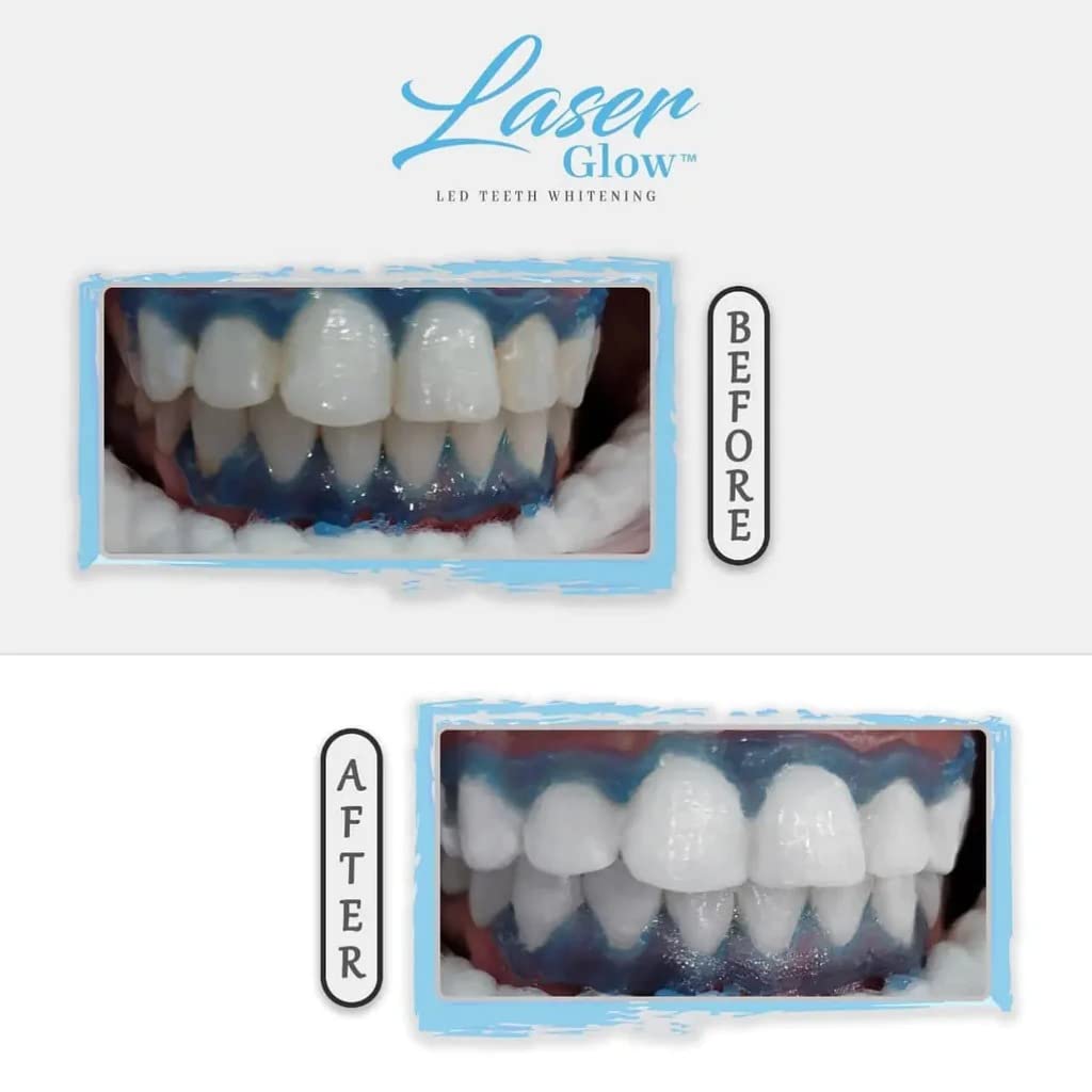 LaserGlow packaging and product box front