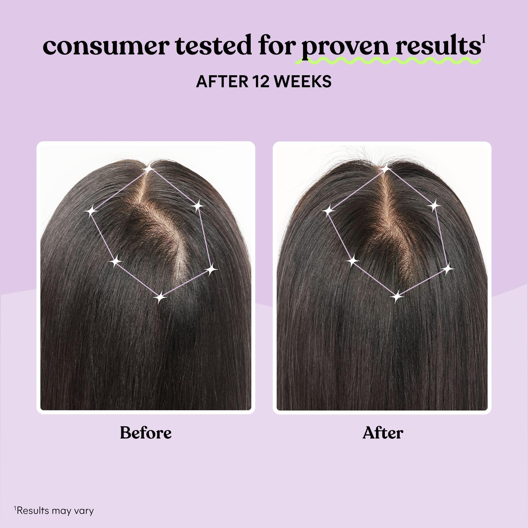 Illustration of thicker, fuller hair showing growth and reduced shedding