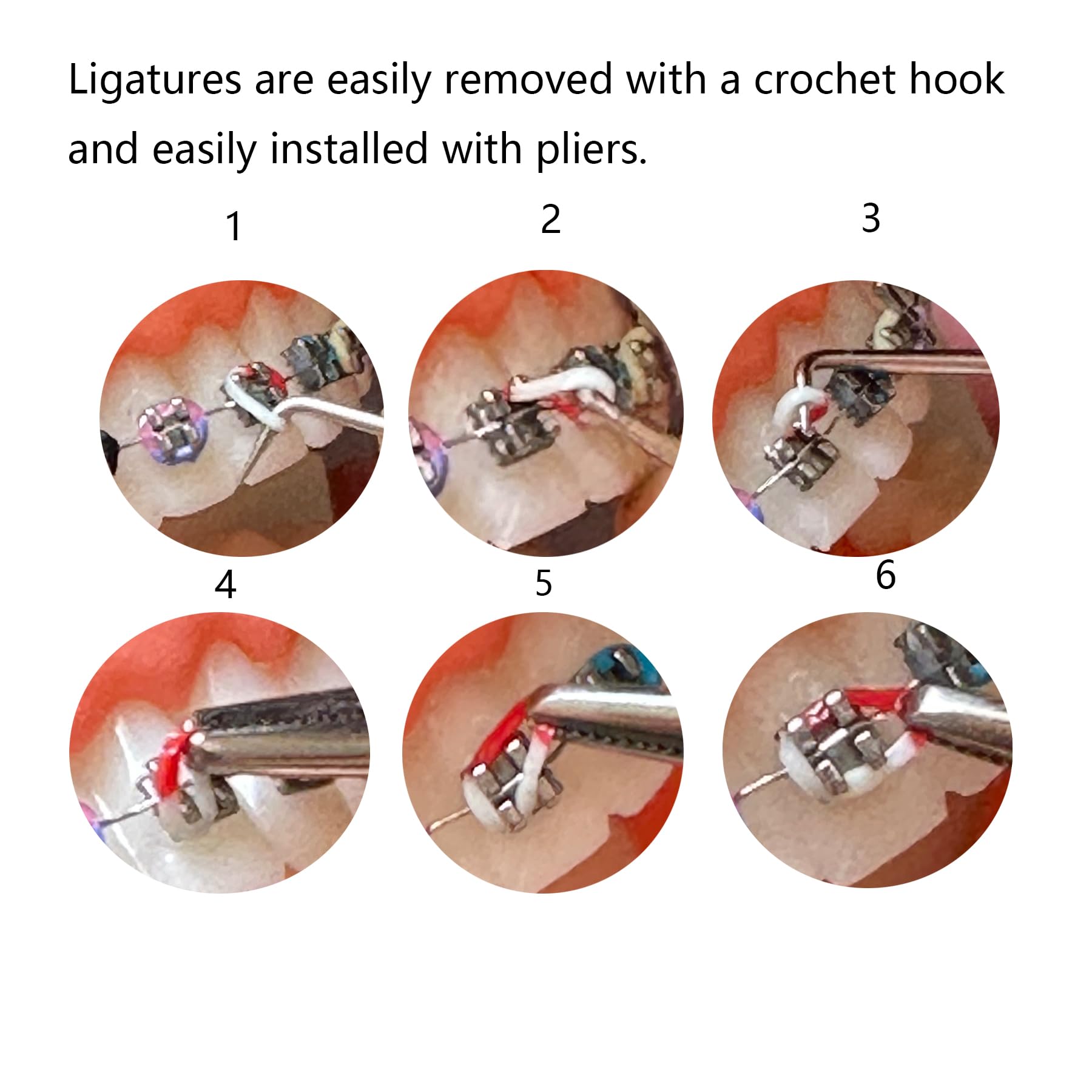 Easy at-home ligature color change process