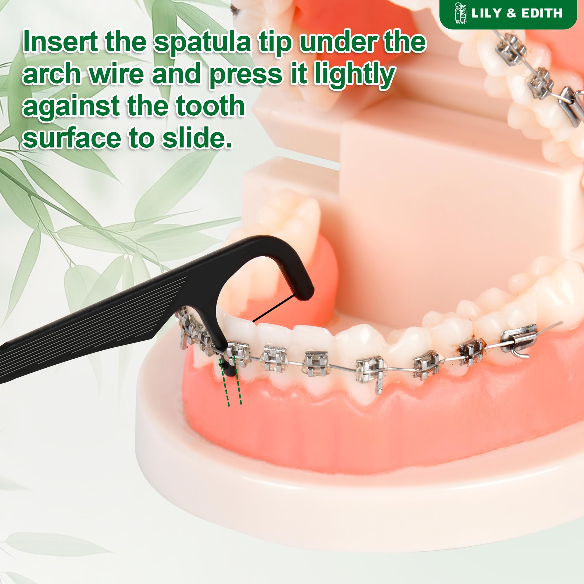 Flosser sliding under arch wire to clean braces