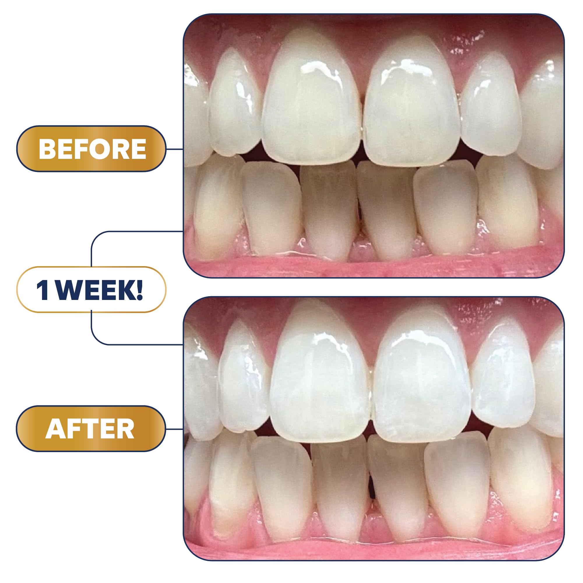 Long lasting whitening results illustration
