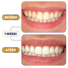 Enamel-safe formula and stain-targeting technology visual