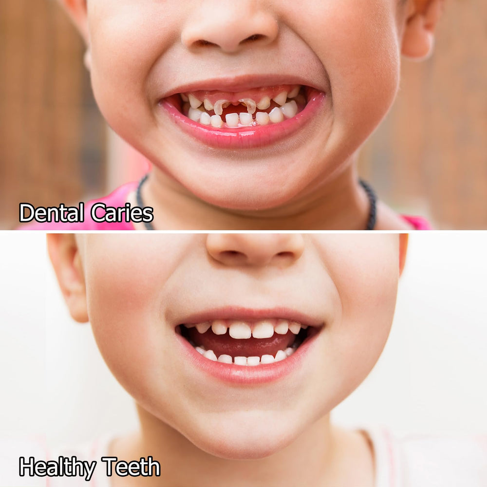 MesoFill enamel protection graphic
